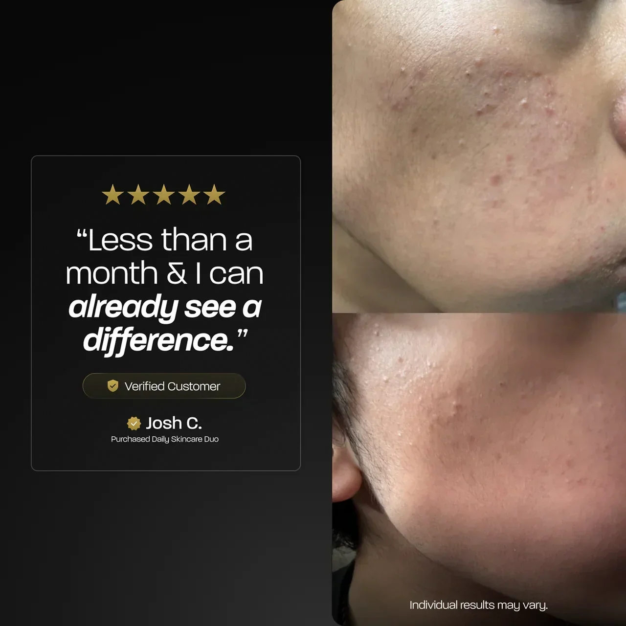 BASED skincare range: before-and-after photos of a man's cheek beside a customer comment panel